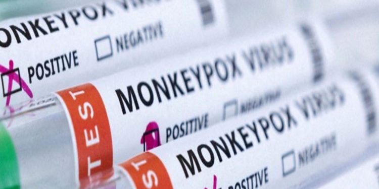 RT-PCR Kit: ਮੰਕੀਪੌਕਸ ਦੀ ਜਾਂਚ ਲਈ ਪਹਿਲੀ ਸਵਦੇਸ਼ੀ RT-PCR ਕਿੱਟ ਲਾਂਚ